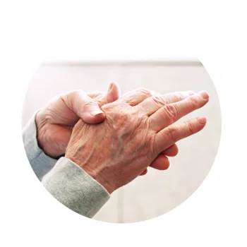 Arthritis Arthritis