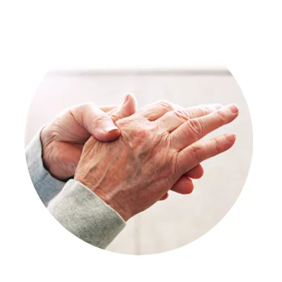 Arthritis Arthritis
