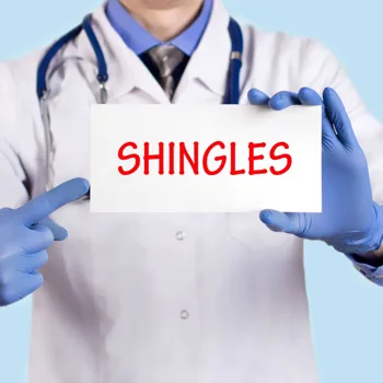 shingles shingles