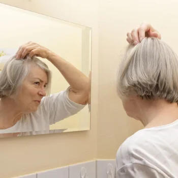 Senior Women and Hair Loss Senior Women and Hair Loss