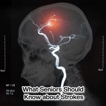 What Seniors Should Know about Strokes What Seniors Should Know about Strokes